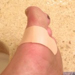 bandage on barefoot injury