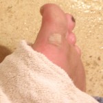 barefoot injury cleaned up