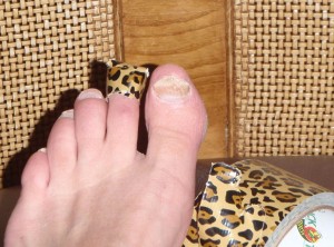 leopard print duct tape was in my Christmas stocking (big toe nail making progress recovering from toenail fungus)