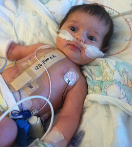 Cori Lou is somewhat swollen 2 days after open heart surgery, but it is already noticeably getting better.