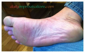What my feet look like about 3 hours after the barefoot run on sharp asphalt.
